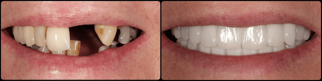 Dr Nigel Hargreaves with a patient following implant treatment